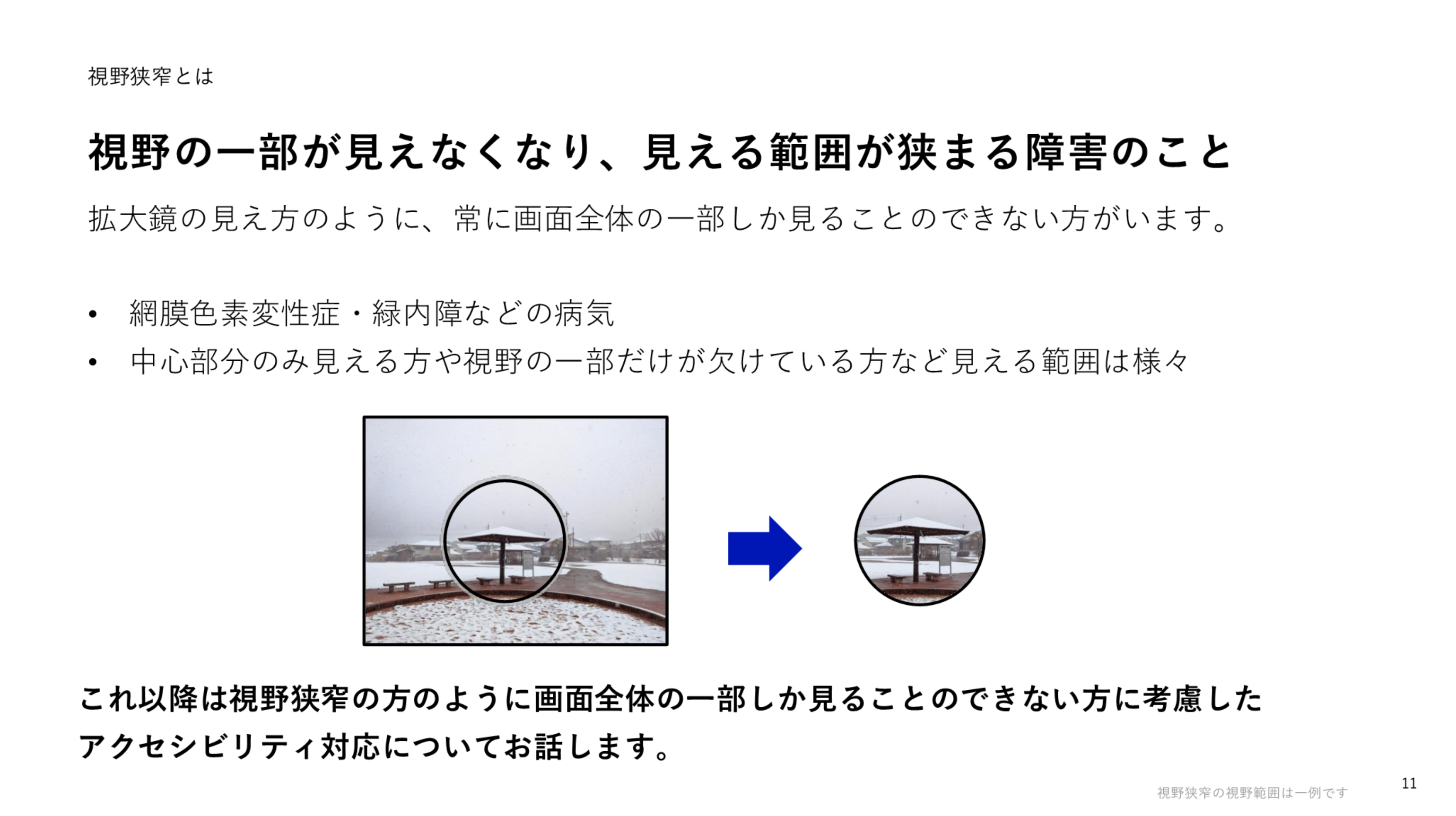 「視野狭窄とは」というタイトルの発表スライド。公園の景色の写真、その一部を円形に切り抜いた写真を左右に並べて視野狭窄の見え方を再現している。